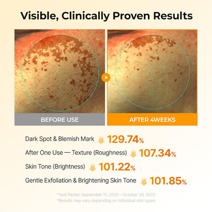 Trynime – LumiBright TX Turmeric Radiance Treatment