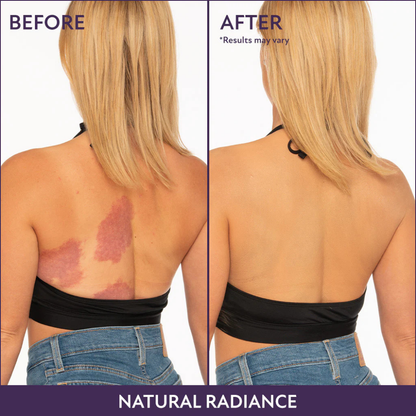 Trynime – BodyPerfect Coverage Duo