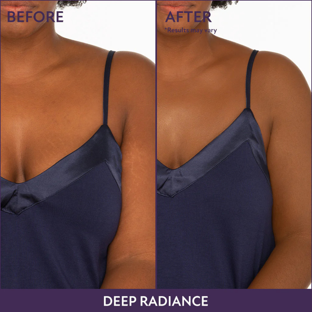 Trynime – BodyPerfect Coverage Duo