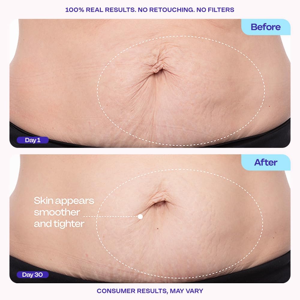 Trynime – SculptTight Belly Firming Cream