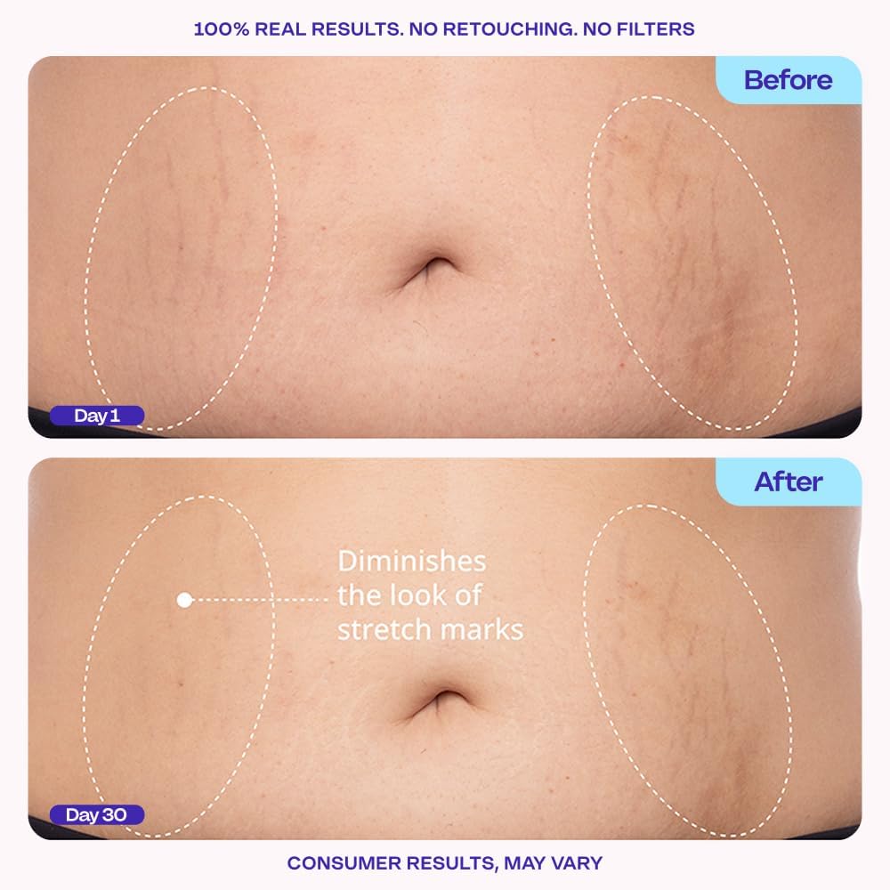 Trynime – SculptTight Belly Firming Cream