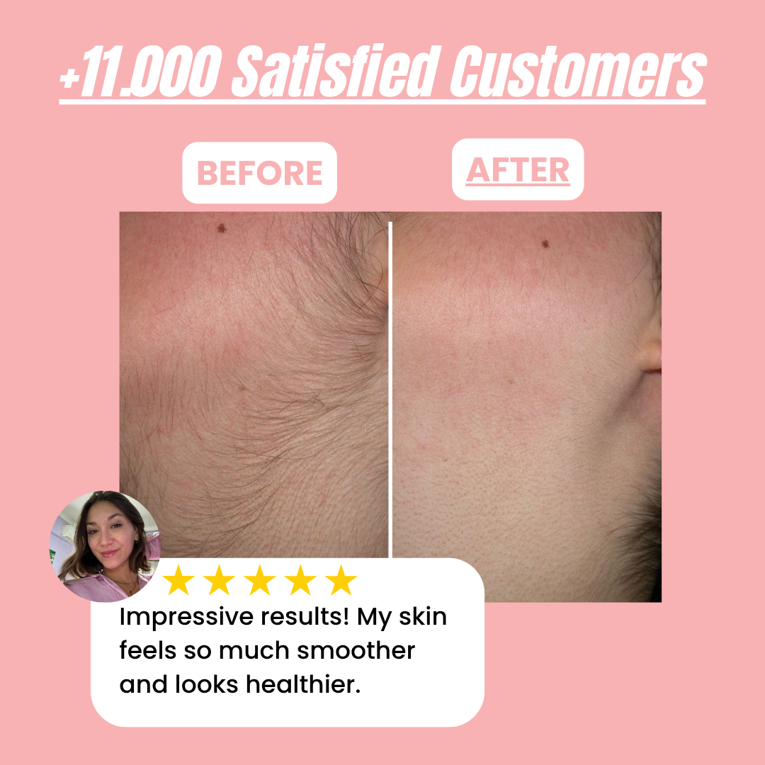 Trynime Instant Hair Removal Kit