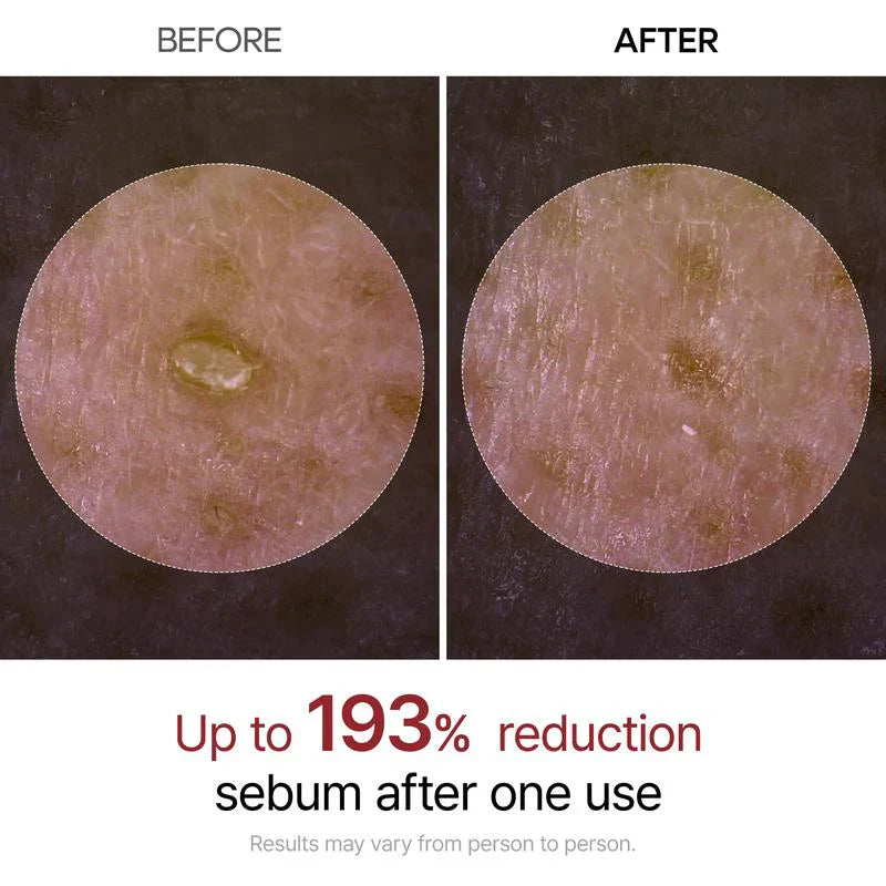 Trynime Peel Shot Glow Rice Ampoule Duo